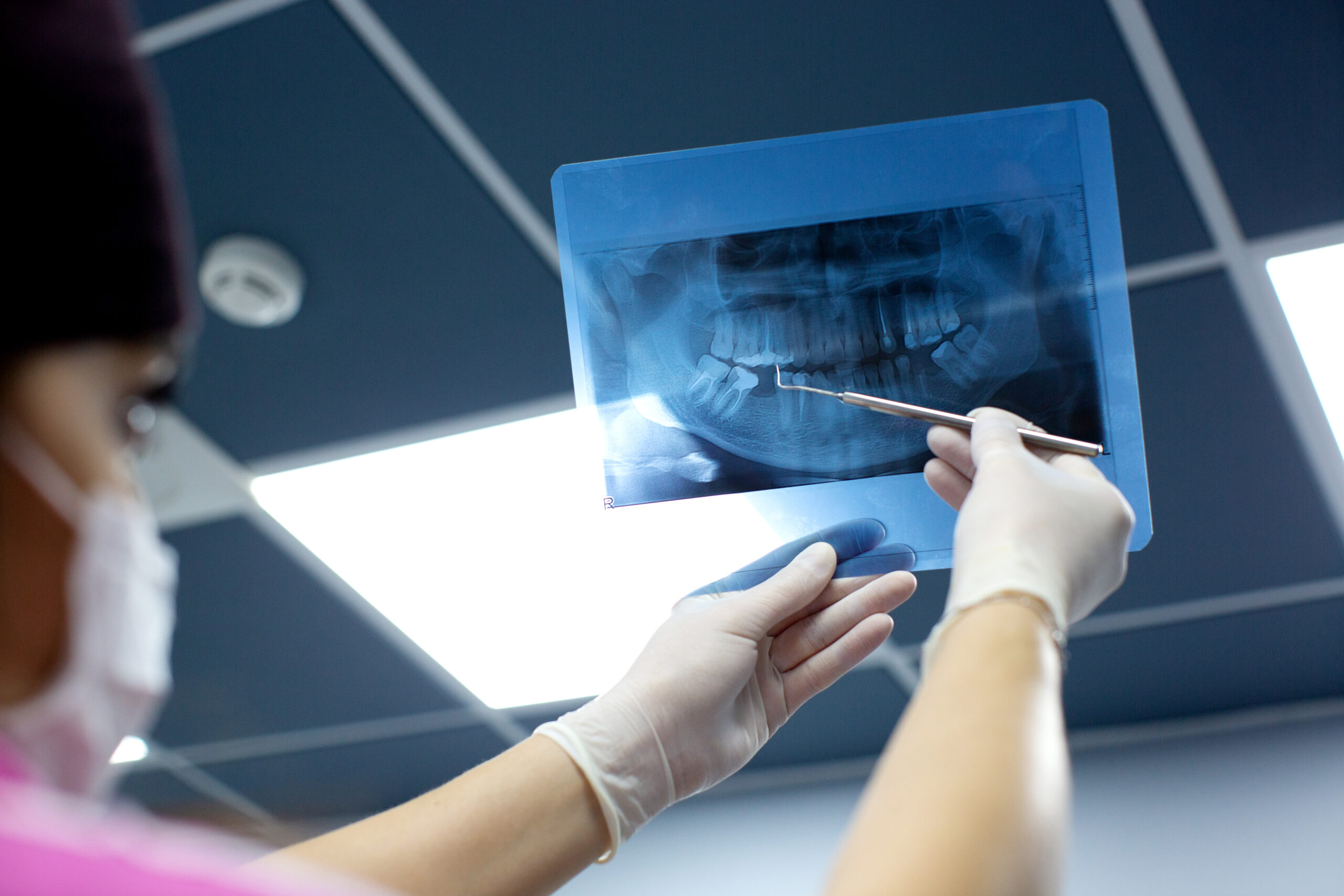 Zdjecie: https://stomatologiarybnik.pl/wp-content/uploads/2023/10/dentysta-sprawdza-zdjecie-rentgenowskie-jamy-ustnej-scaled.jpg